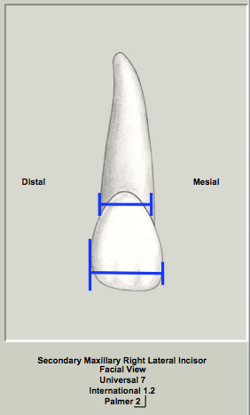 Mx Lateral Crown Width Facial.png